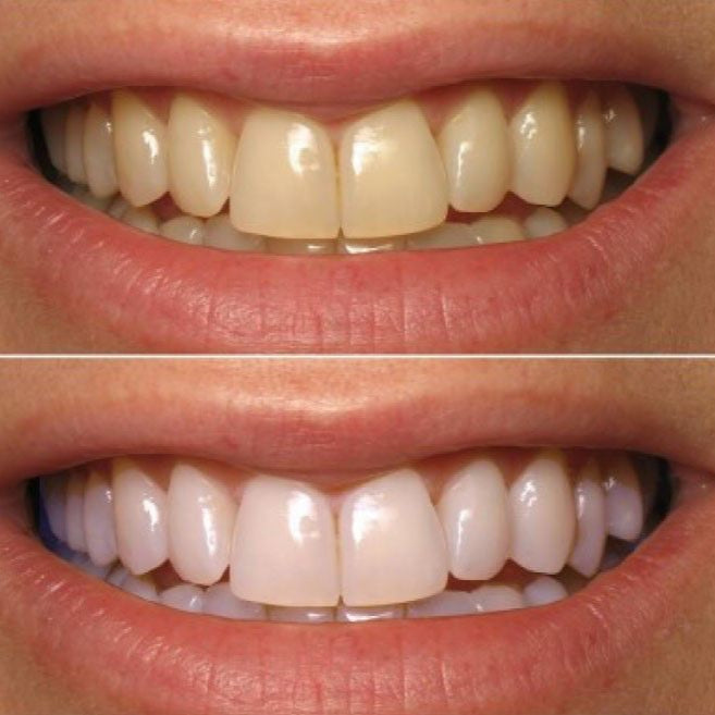 PASTA DENTAL BLANQUEADORA OBSESSIVE